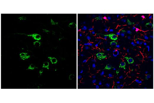 Immunofluorescence Image 1: Osteopontin/SPP1 (E4O2F) Rabbit Monoclonal Antibody