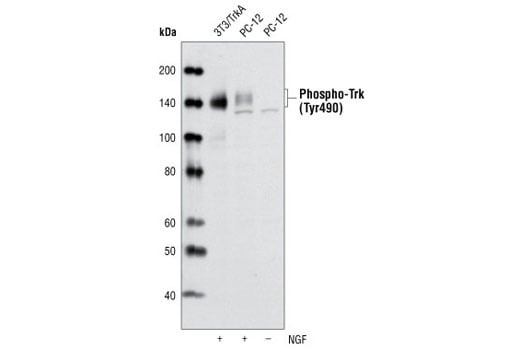 Western Blotting Image 2: Phospho-TrkA (Tyr490)/TrkB (Tyr516) (C35G9) Rabbit Monoclonal Antibody