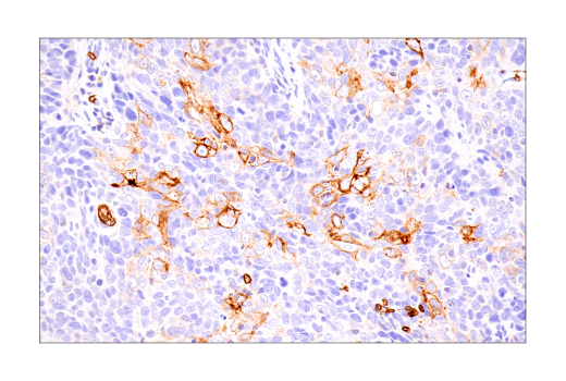 Immunohistochemistry Image 4: Glut1 (IHC404) Mouse Monoclonal Antibody