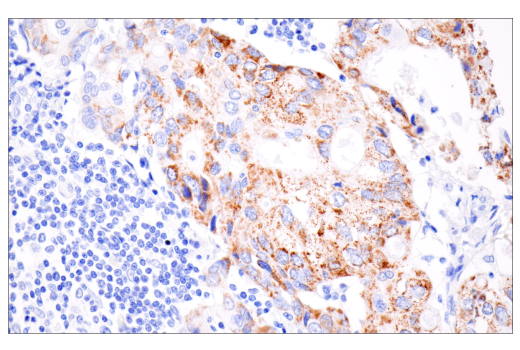 Immunohistochemistry Image 2: CPS1/Hep Par-1 (E9I9U) Rabbit Monoclonal Antibody (BSA and Azide Free)