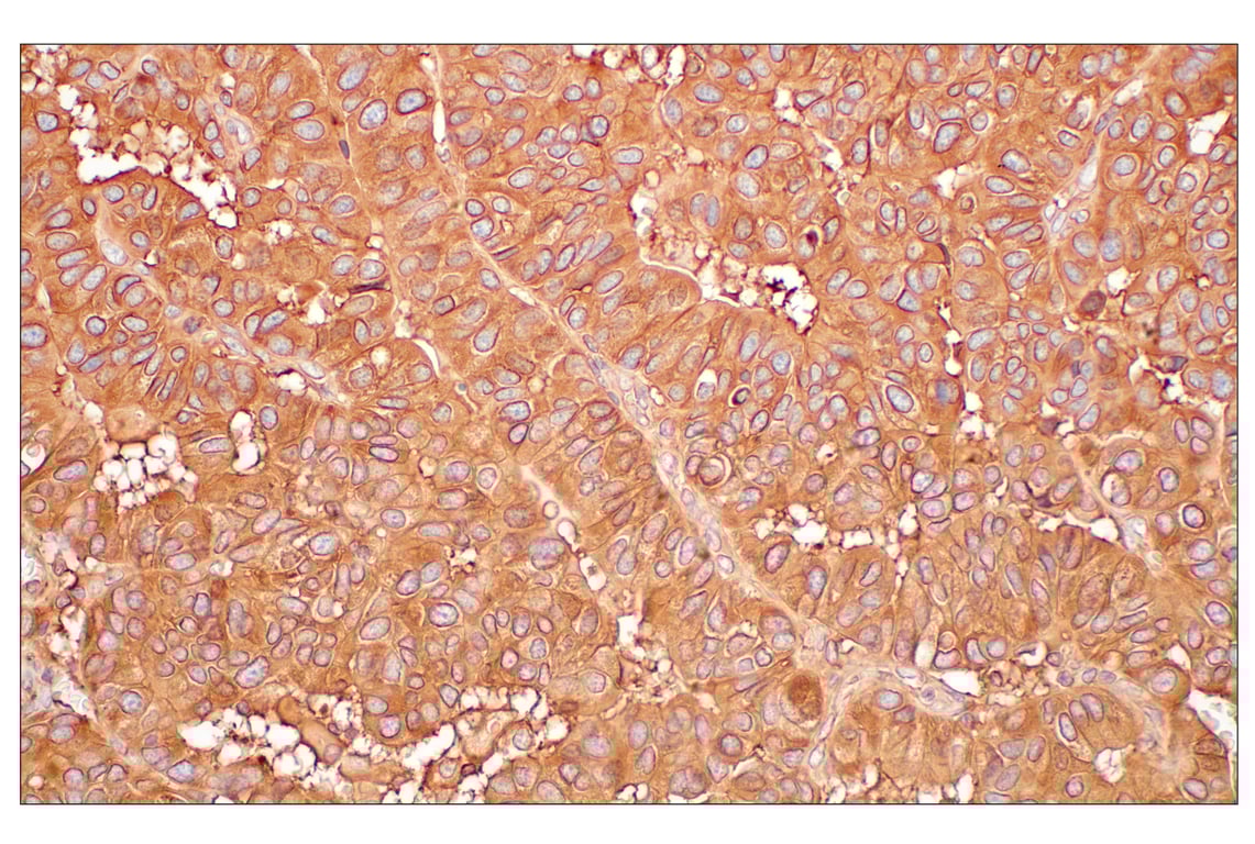 Immunohistochemistry Image 8: MHC Class I (EMR8-5) Mouse Monoclonal Antibody