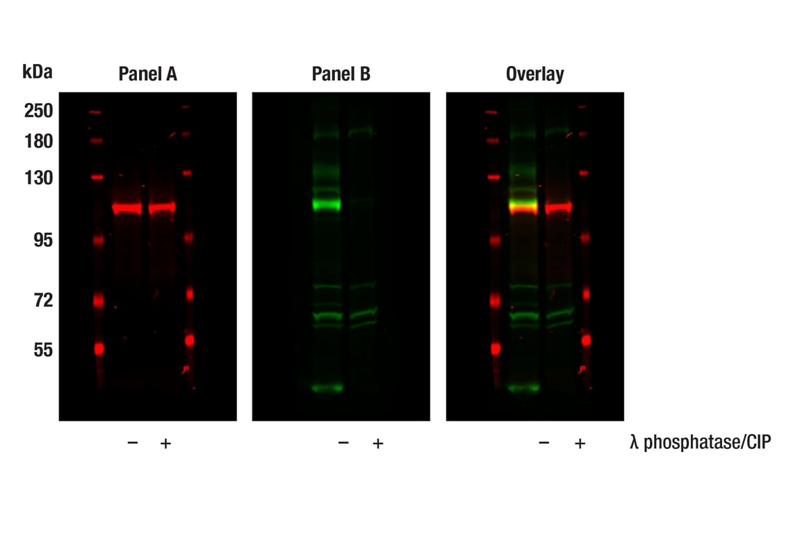 Western Blotting Image 1: Rb (4H1) Mouse Monoclonal Antibody