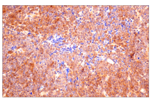 Immunohistochemistry Image 9: VHL (E3X9K) Rabbit Monoclonal Antibody