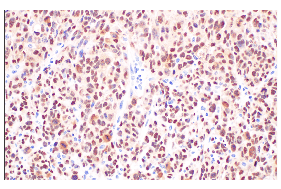 Immunohistochemistry Image 6: Sox10 (E2V9N) Rabbit Monoclonal Antibody (BSA and Azide Free)