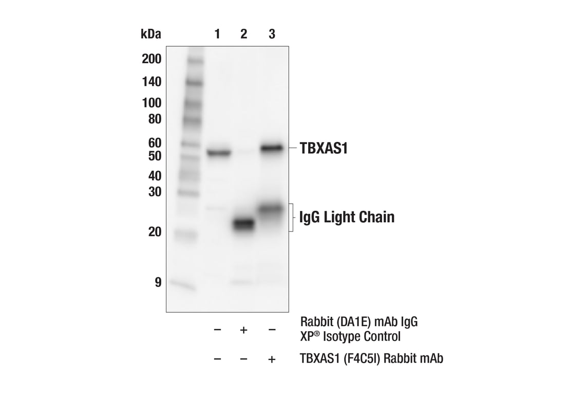 Immunoprecipitation Image 1: TBXAS1 (F4C5I) Rabbit Monoclonal Antibody