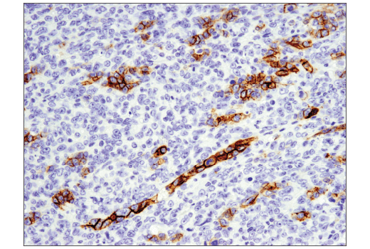 Immunohistochemistry Image 2: EpCAM (E6V8Y) Rabbit Monoclonal Antibody