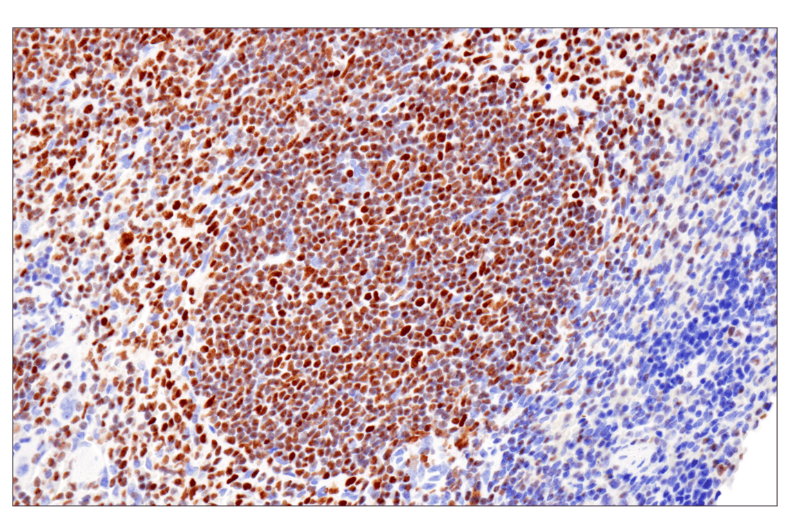 Immunohistochemistry Image 3: Ikaros (D6N9Y) Rabbit Monoclonal Antibody