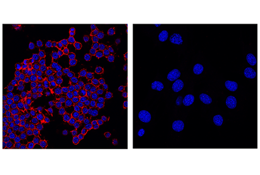 Immunofluorescence Image 1: CD45 (D3F8Q) Rabbit Monoclonal Antibody (Alexa Fluor<sup>®</sup> 555 Conjugate)