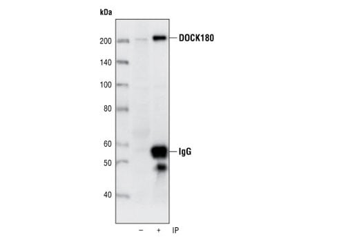 Immunoprecipitation Image 1: DOCK180 (C4C12) Rabbit Monoclonal Antibody
