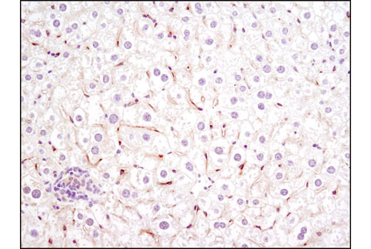 Immunohistochemistry Image 1: VEGF Receptor 2 (D5B1) Rabbit Monoclonal Antibody (BSA and Azide Free)