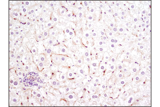 Immunohistochemistry Image 1: VEGF Receptor 2 (D5B1) Rabbit mAb (BSA and Azide Free)