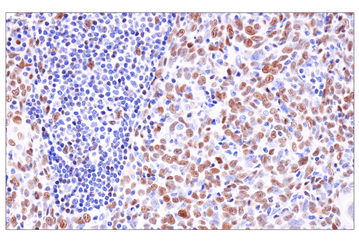 Immunohistochemistry Image 1: ADAR2 (F6U8S) Rabbit Monoclonal Antibody