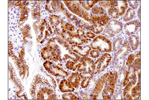 Immunohistochemistry Image 1: Non-phospho (Active) beta-Catenin (Ser45) (D2U8Y) Rabbit Monoclonal Antibody