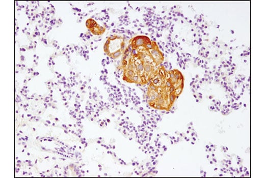 Immunohistochemistry Image 3: Phospho-PRAS40 (Thr246) (D4D2) Rabbit Monoclonal Antibody