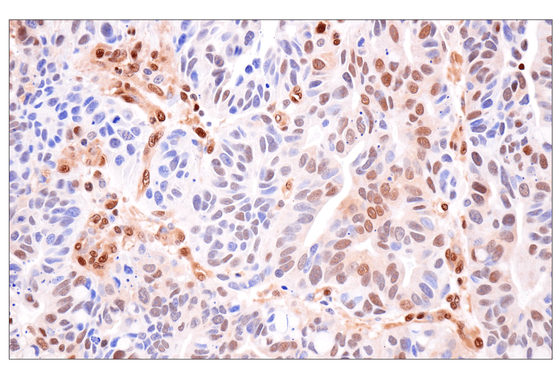 Immunohistochemistry Image 2: Phospho-ATP-Citrate Lyase (Ser455) (F4T8R) Rabbit Monoclonal Antibody