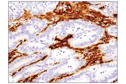 Immunohistochemistry Image 2: Podoplanin (LpMab-12) Mouse Monoclonal Antibody