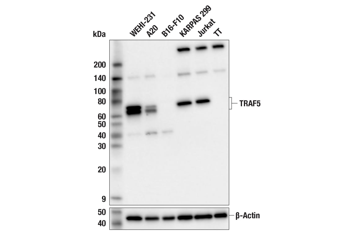 Western Blotting Image 2: TRAF5 (F6W4N) Rabbit Monoclonal Antibody