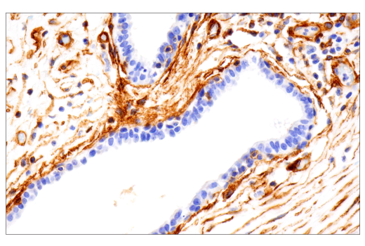 Immunohistochemistry Image 4: Integrin alpha1/CD49a (E9K2J) Rabbit Monoclonal Antibody