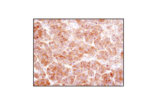 Immunohistochemistry Image 2: Fatty Acid Synthase (C20G5) Rabbit Monoclonal Antibody