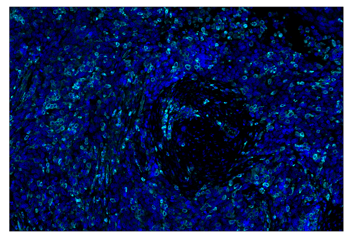 Immunohistochemistry Image 2: VISTA (D1L2G) & CO-0185-647 SignalStar<sup>®</sup> Oligo-Antibody Pair