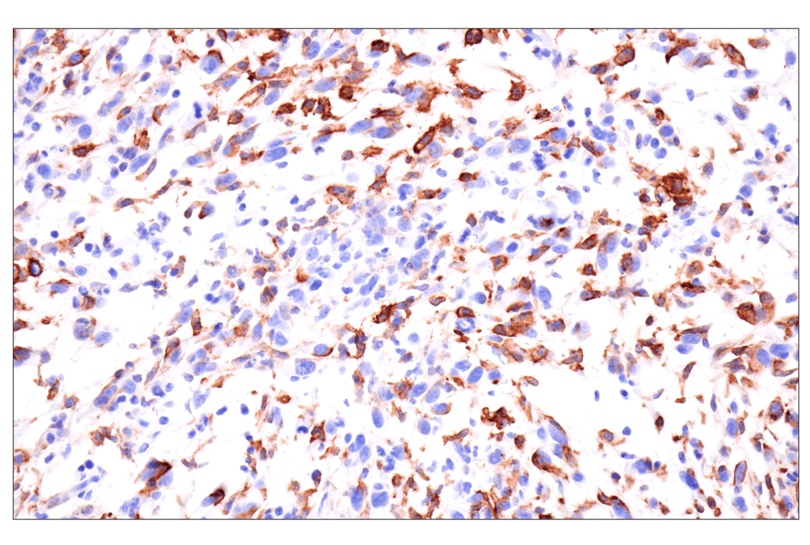 Immunohistochemistry Image 2: CD22 (F9D1W) Rabbit Monoclonal Antibody