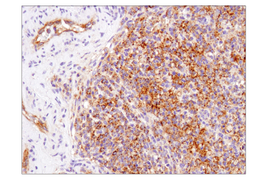 Immunohistochemistry Image 1: MX1 (D3W7I) Rabbit Monoclonal Antibody (BSA and Azide Free)