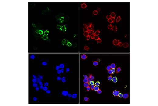 Immunofluorescence Image 1: TIGIT (E5Y1W) Rabbit Monoclonal Antibody