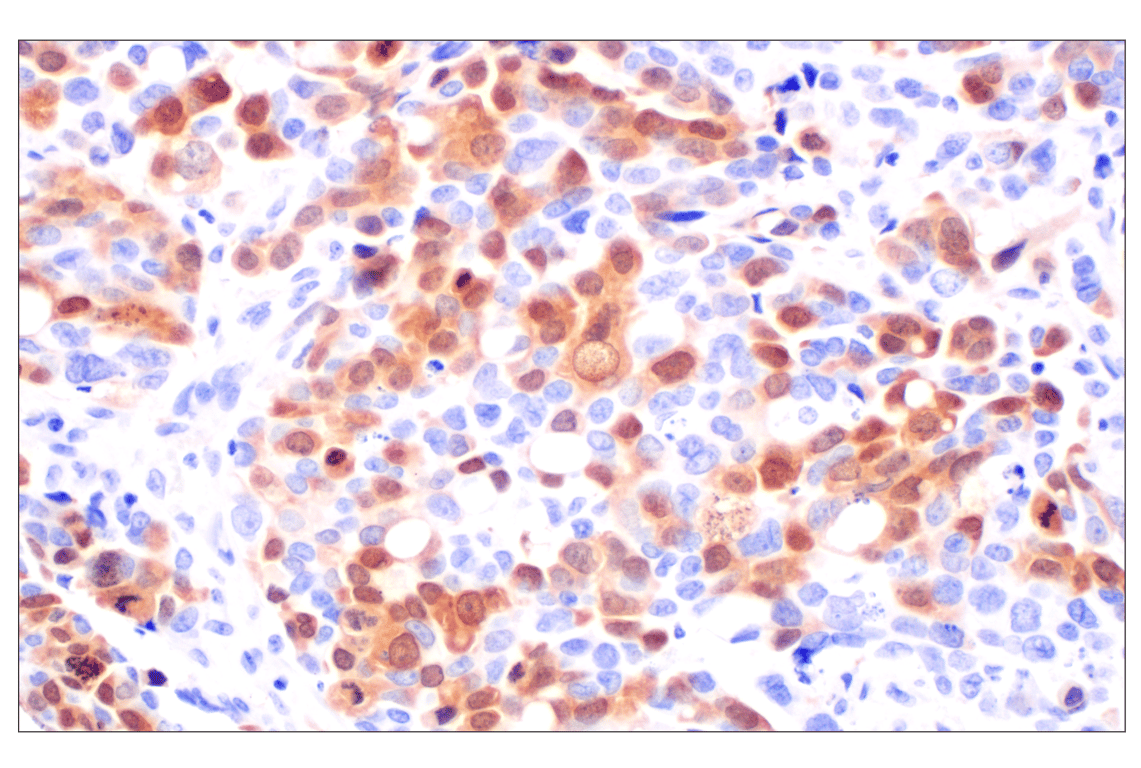 Immunohistochemistry Image 1: Thymidine Kinase 1 (E2H7Z) Rabbit Monoclonal Antibody