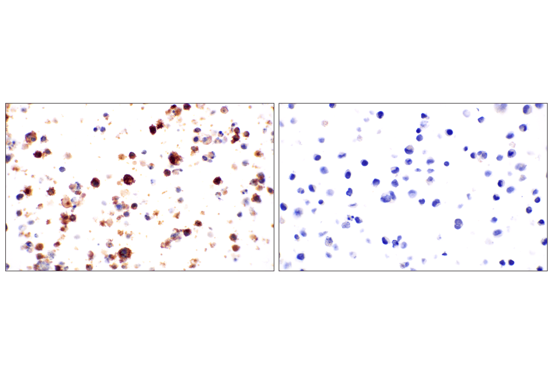 Immunohistochemistry Image 6: CR1/CD35 (E8B1Z) Rabbit Monoclonal Antibody