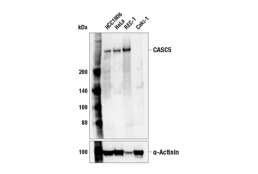 Western Blotting Image 1: CASC5 (E4A5L) Rabbit mAb