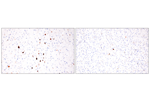 Immunohistochemistry Image 5: Tau (GT-38) Mouse Monoclonal Antibody