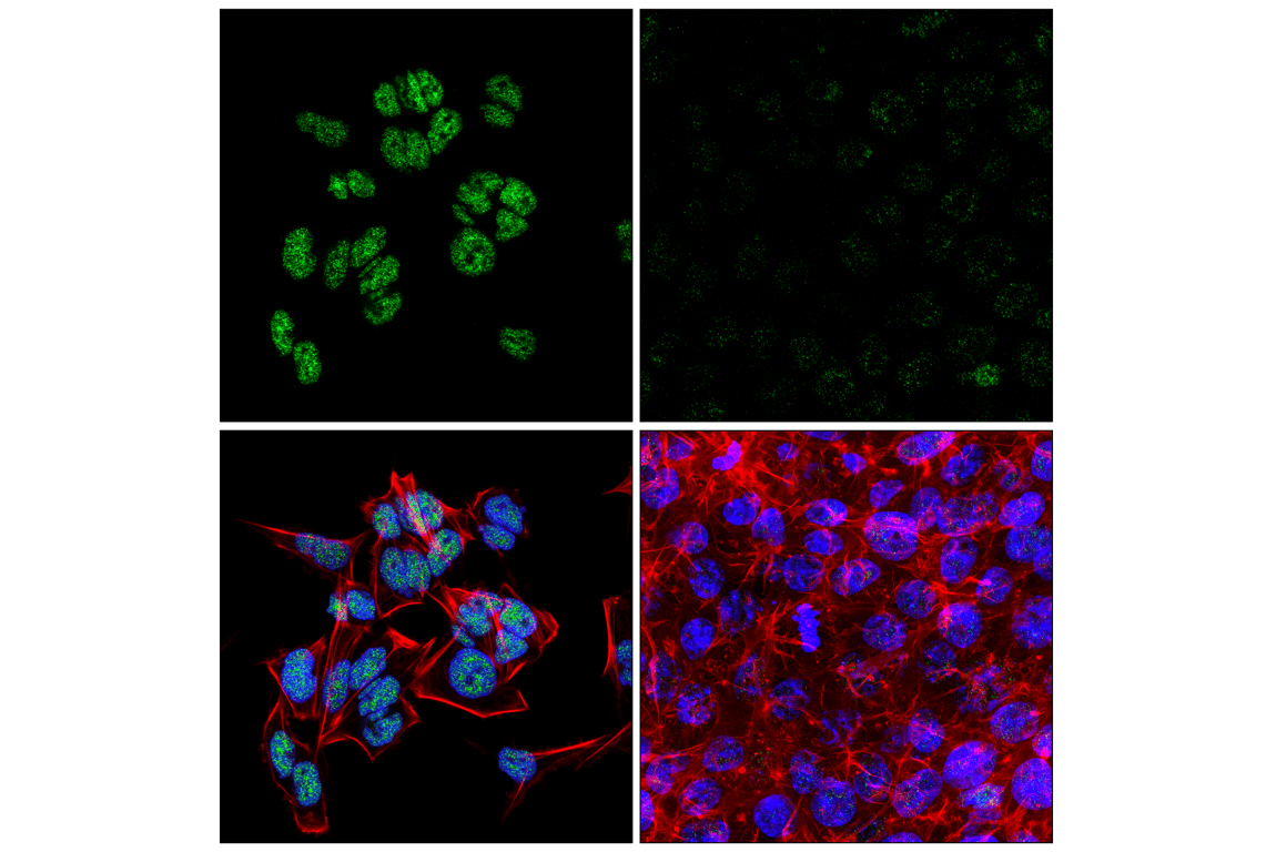 Immunofluorescence Image 1: FoxK1 (E4D1V) Rabbit Monoclonal Antibody