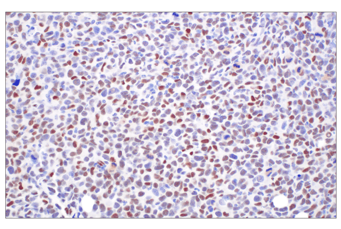 Immunohistochemistry Image 1: TCF4/ITF2 (E3X2Y) Rabbit Monoclonal Antibody