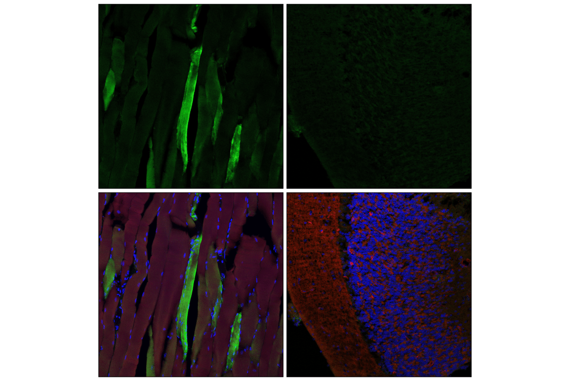 Immunofluorescence Image 1: HSP20 (E9Z1O) Rabbit Monoclonal Antibody