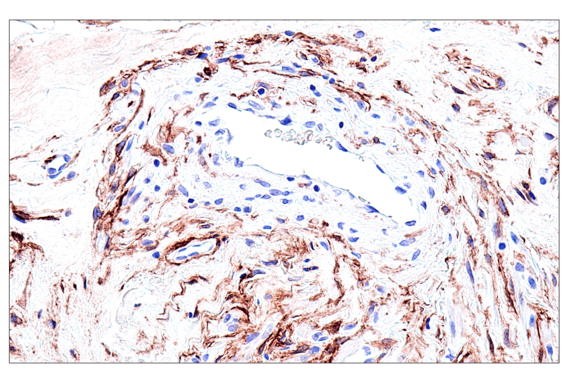 Immunohistochemistry Image 4: FAP (F1A4G) Rabbit Monoclonal Antibody