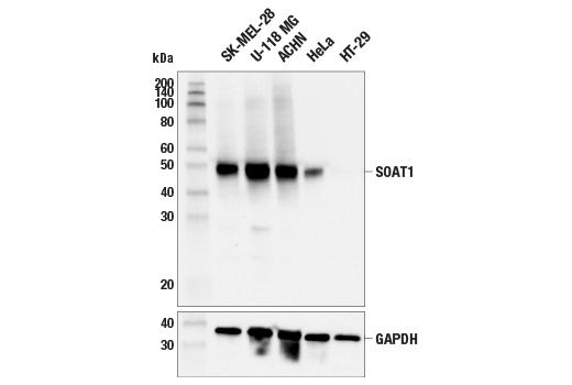 Western Blotting Image 1: SOAT1 (E5O4K) Rabbit mAb