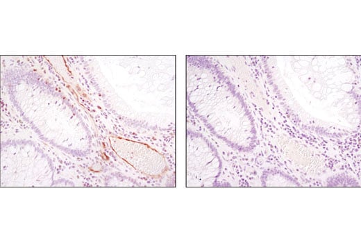 Immunohistochemistry Image 1: Phospho-PLC gamma1 (Ser1248) (D25A9) Rabbit Monoclonal Antibody (BSA and Azide Free)