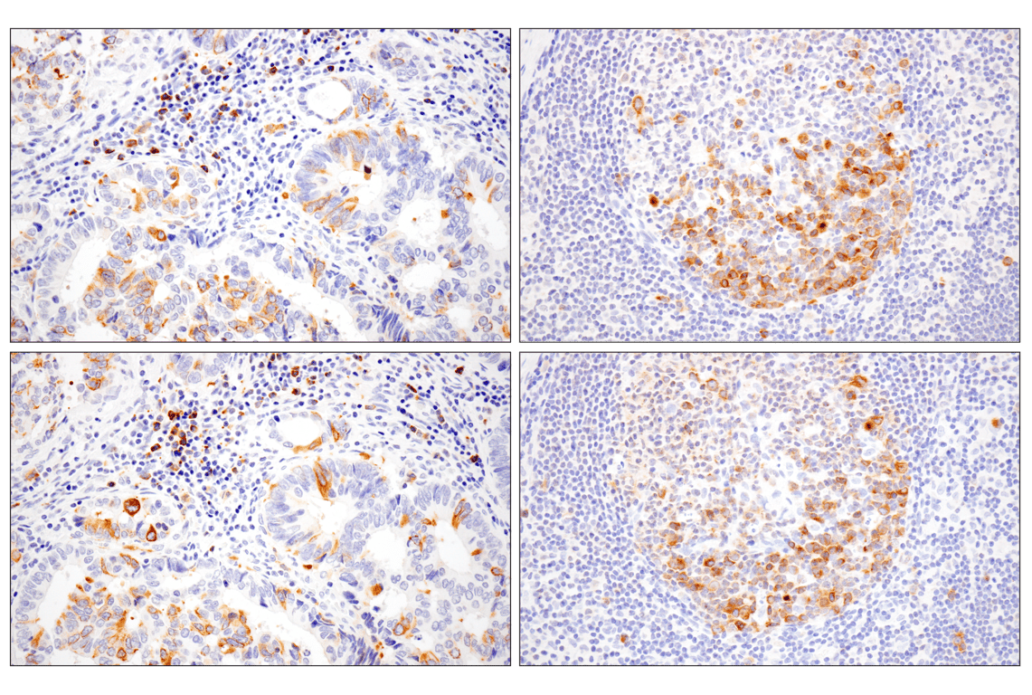 Immunohistochemistry Image 9: Eg5 (E1L3W) Rabbit Monoclonal Antibody