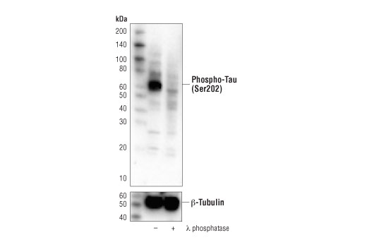 Western Blotting Image 2: Phospho-Tau (Ser202) (D4H7E) Rabbit Monoclonal Antibody