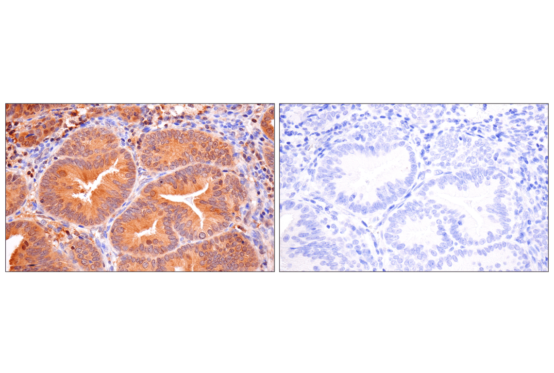 Immunohistochemistry Image 10: Caspase-8 (F5K9P) Rabbit Monoclonal Antibody (BSA and Azide Free)
