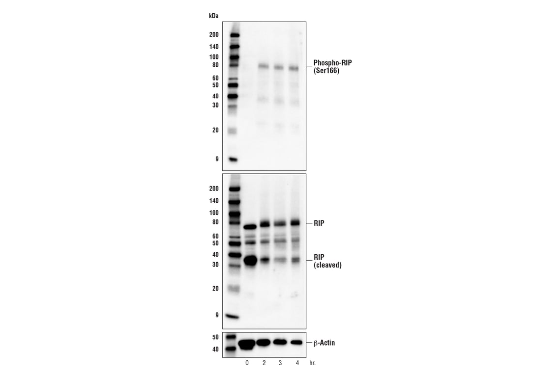 Western Blotting Image 2: Phospho-RIP (Ser166) (E7G6O) Rabbit Monoclonal Antibody