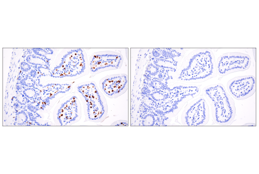 Immunohistochemistry Image 4: CD3 epsilon (E4T1B) Rabbit Monoclonal Antibody (BSA and Azide Free)