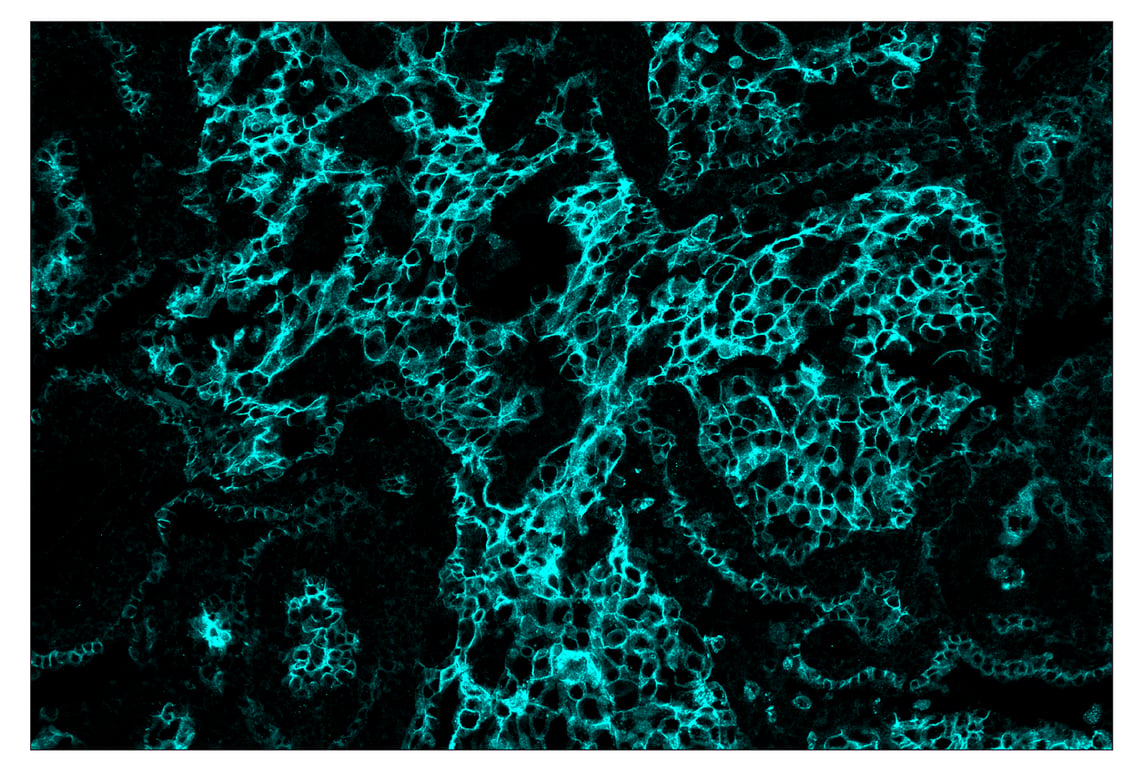 Immunohistochemistry Image 5: HER2/ErbB2 (D8F12) & CO-0019-488 SignalStar<sup>™</sup> Oligo-Antibody Pair