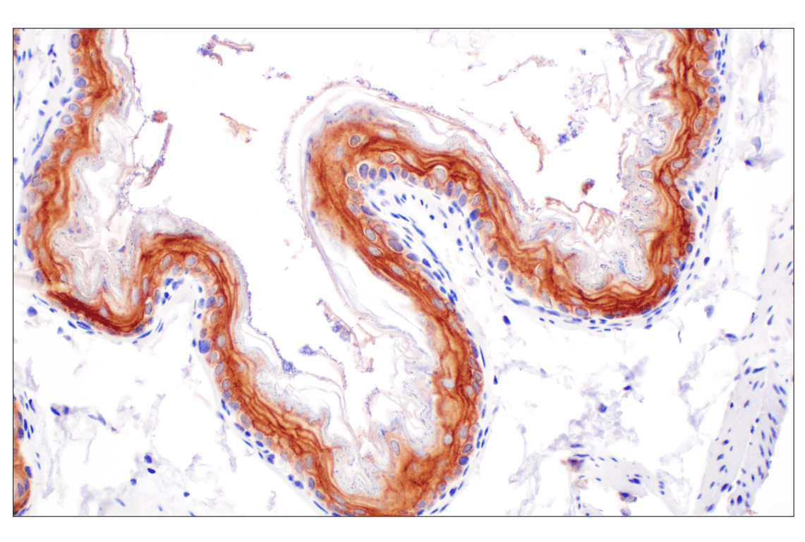 Immunohistochemistry Image 9: Desmoplakin (F3J8Y) Rabbit Monoclonal Antibody