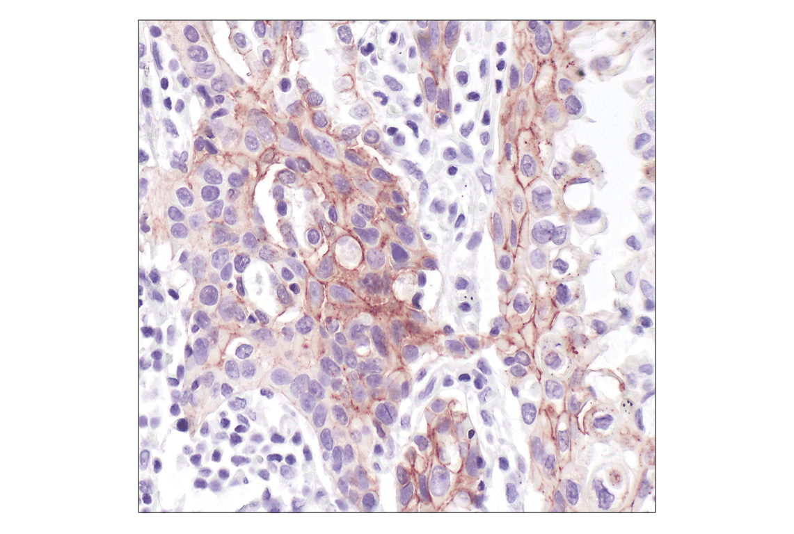Immunohistochemistry Image 1: E-Cadherin (24E10) Rabbit Monoclonal Antibody