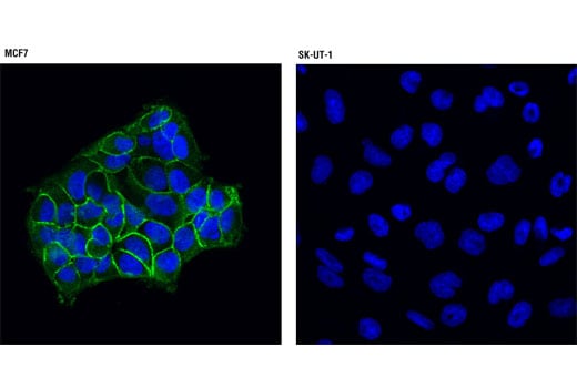 undefined Image 15: Insulin/IGF-1 Signaling Pathway Antibody Sampler Kit