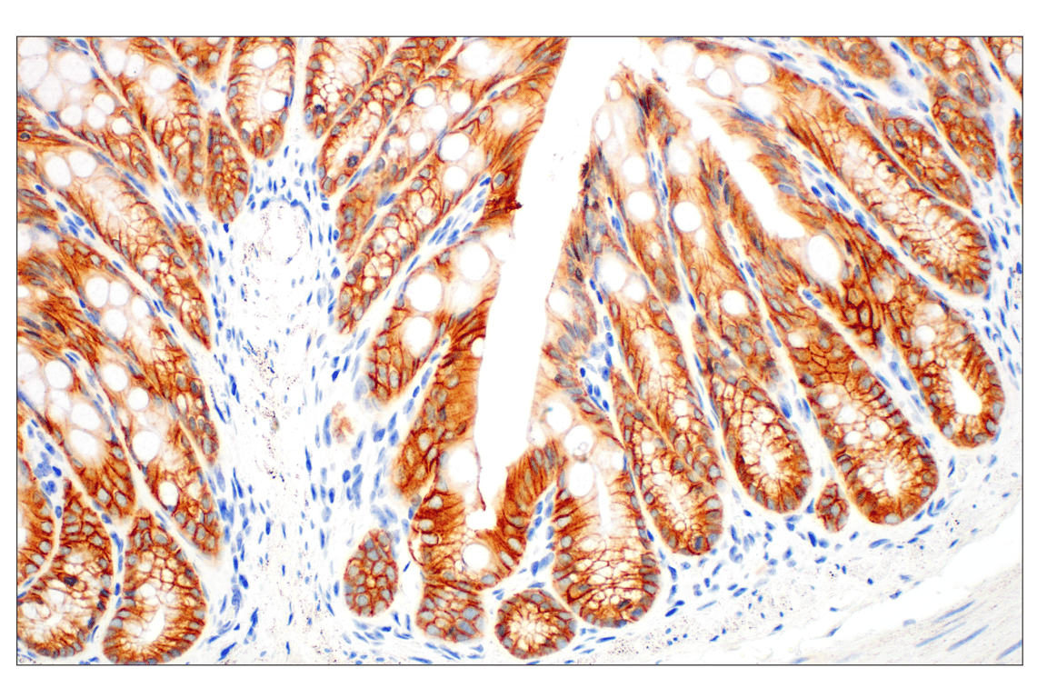 Immunohistochemistry Image 5: E-Cadherin (24E10) Rabbit Monoclonal Antibody