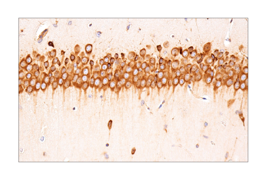 Immunohistochemistry Image 14: UBAP2L (E5X4E) Rabbit Monoclonal Antibody