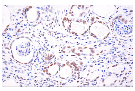 Immunohistochemistry Image 3: ATRX (E5X7O) Rabbit Monoclonal Antibody