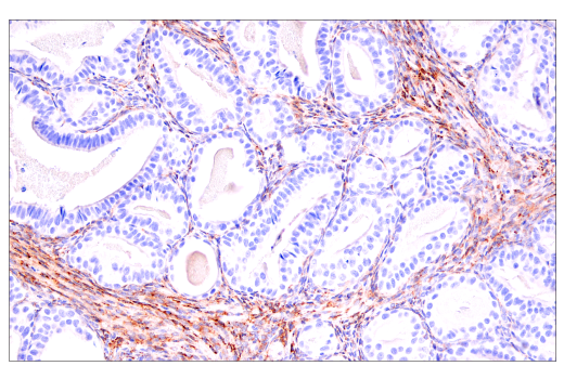 Immunohistochemistry Image 5: COL5A1 (E6U9W) Rabbit Monoclonal Antibody